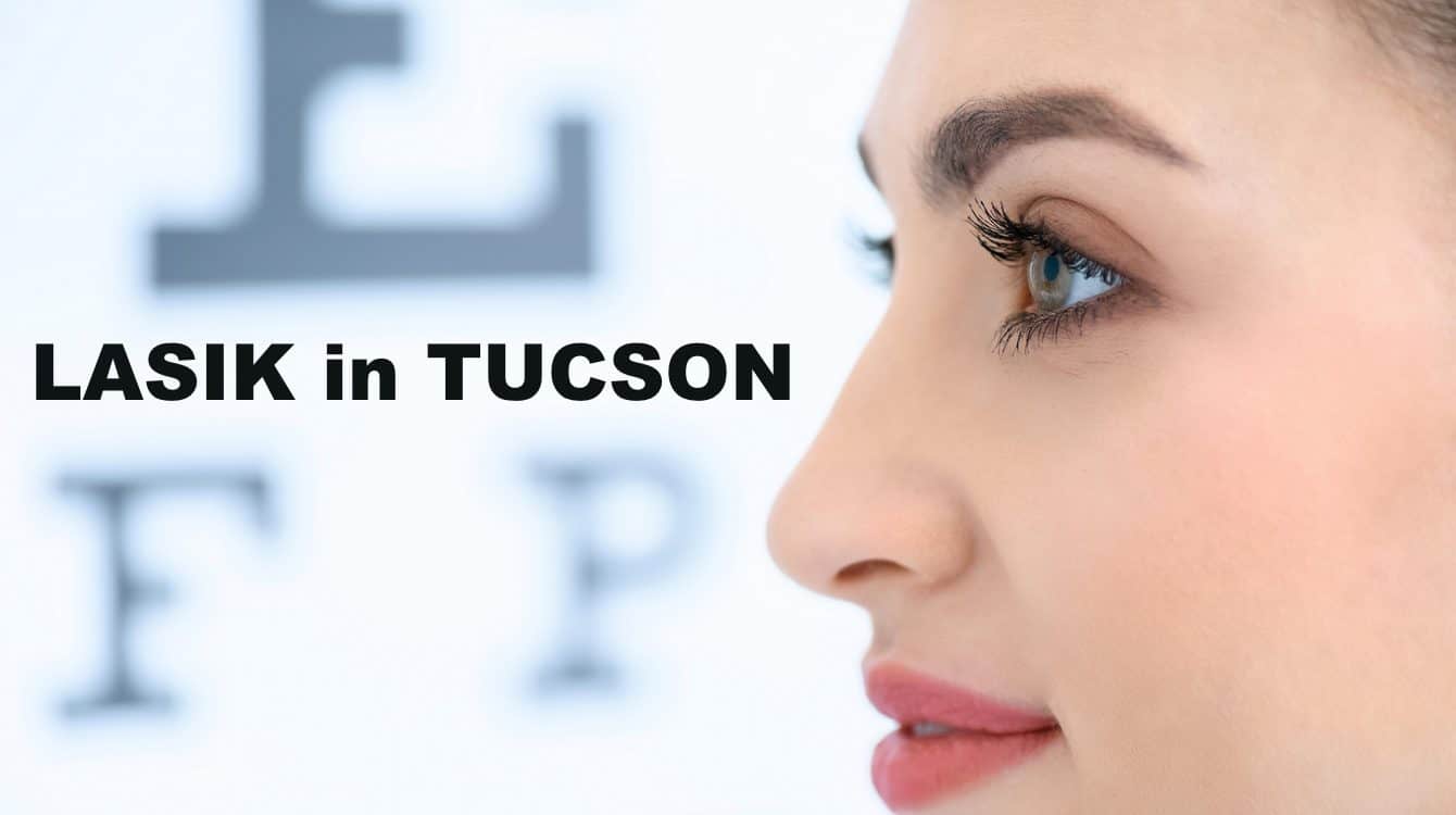 LASIK Tucson | LASIK in Tucson
